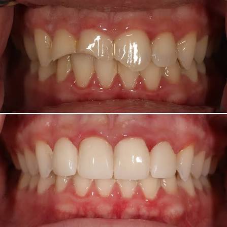 Patient smile transformation 5