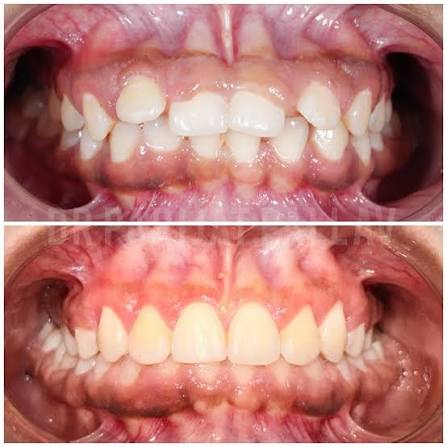 Patient smile transformation 8